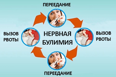 Лечение булимии в Бронницах